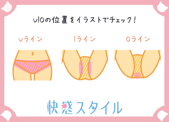 VIOの位置がわかる画像